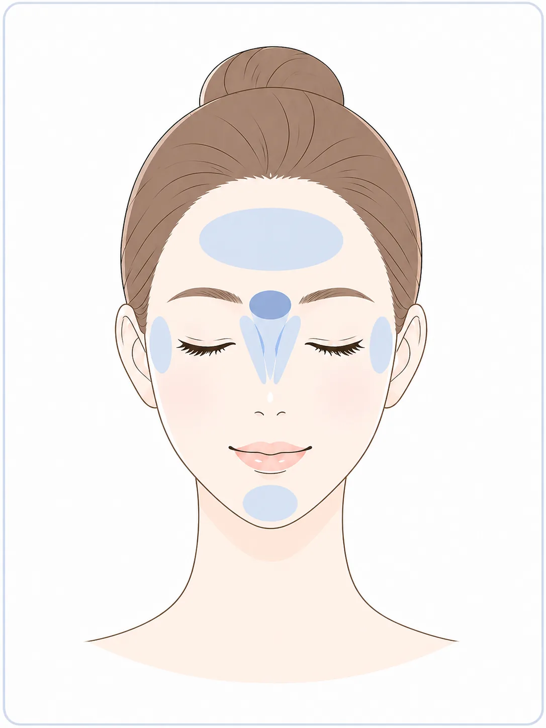 表情じわのボトックス施術部位イラスト
